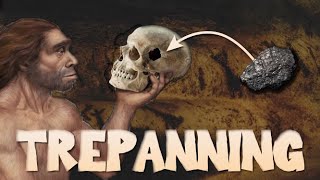 The History of Trepanning [upl. by Olinde942]