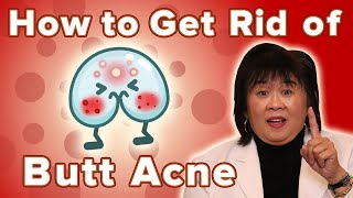 How To Get Rid Of Butt Acne [upl. by Egan]