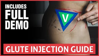 How To Do A Glute Injection  Full Guide And Demo [upl. by Eizzo66]