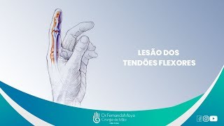 Lesão dos tendões flexores  Dr Fernando Moya CRM 112046 [upl. by Aivatahs641]