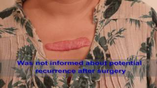 Chest Keloids  Mistakes to Avoid [upl. by Ameg]