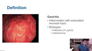 Gastritis vs Gastropathy [upl. by Noryb]