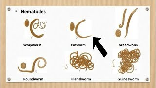 Pinworms Threadworm Infection [upl. by Nitsuj728]