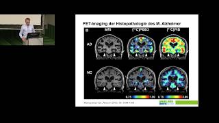 Neurobiologische Grundlagen psychischer Störungen [upl. by Eener]