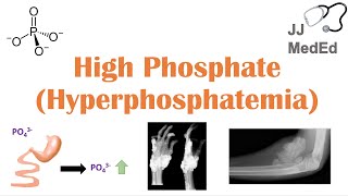 High Phosphate Hyperphosphatemia Dietary Sources Causes Symptoms Treatment [upl. by Dorrehs]