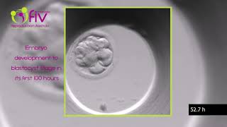 TimeLapse  Embryo development ENG first 100 hours [upl. by Artair367]