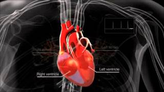 What is atrial fibrillation [upl. by Nesnej269]