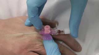 Cannulation How to gain IV access [upl. by Ackerman]