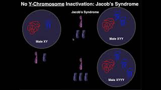 Jacobs Syndrome  A YChromosome Aneuploidy [upl. by Ahsiekit763]