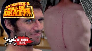 Guys Broken Body  Guy Martin Proper [upl. by Sims372]