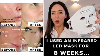 I used the CurrentBody LED Mask for 8 weeks amp this happened [upl. by Adnamma]