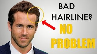 5 Awesome Hairstyles for Widows Peak  Receding Hairline [upl. by Adalai493]