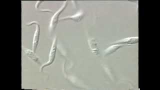 Trypanosoma [upl. by Favian]