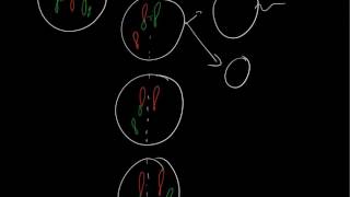 Robertsonian translocation 21q14q [upl. by Merilee]