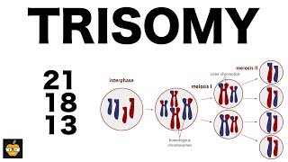 Trisomy 21 18 and 13 amp Nondisjunction Genetics [upl. by Artus]