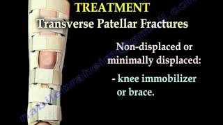 Patellofemoral Syndrome Anterior Knee Pain What Can You Do About It [upl. by Tiena]