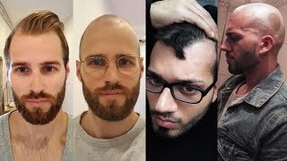 BALDING MEN EMBRACE GOING BALD  BaldCafe Head Shave INSPIRATION [upl. by Cyma149]