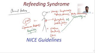 Refeeding Syndrome  NICE Guidelines  General Surgery Lectures  MRCS MS DNB [upl. by Ylimme601]