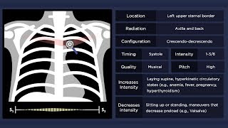 Pulmonary Flow Murmur [upl. by Elsa]