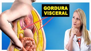 Como Perder Gordura Visceral Rápido  DIMINUA A BARRIGA [upl. by Ecylahs37]