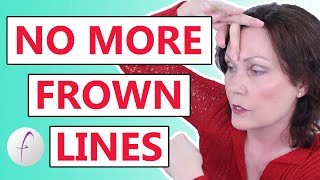 How to Remove Frown Lines Naturally [upl. by Lenka]