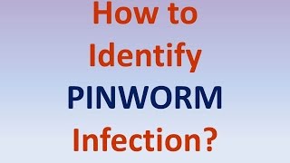 How to identify pinworm infection [upl. by Nohtiek96]