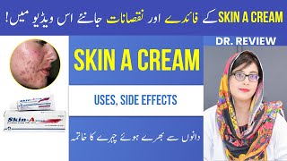 Dr Reviewed SKIN A CREAM  Uses  Side Effects  Tretinoin Cream  Beauty Facts  UrduHindi [upl. by Given484]