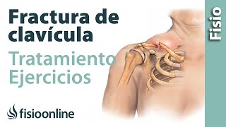 FRACTURA de CLAVÍCULA Rehabilitación ejercicios y tiempo de RECUPERACIÓN [upl. by Nhguahs]