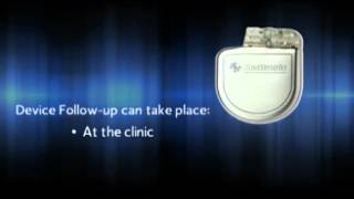 What is an Implantable Cardioverter Defibrillator ICD [upl. by Frodine]