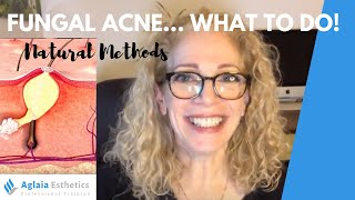 HOW TO CLEAR FUNGAL ACNE NATURALLY  NO MEDICATION OR NIZORAL [upl. by Antonella]