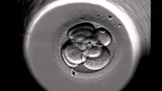 ivf embryo developing over 5 days by fertility Dr Raewyn Teirney [upl. by Lowrie]