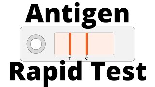 How SARSCoV2 Antigen Rapid Tests work Covid19 Testing [upl. by Krispin129]