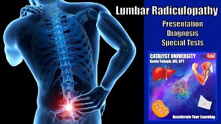 Lumbar Radiculopathies  Presentation Diagnosis amp Special Tests [upl. by Cahan]