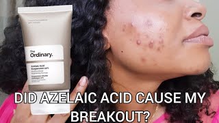 The Ordinary 10 Azelaic acid Suspension for Acne and Hyperpigmentation on Dark skin Review [upl. by Gris]