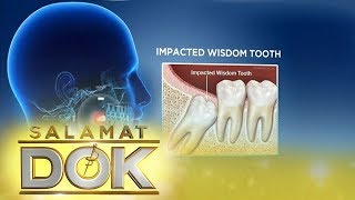 Salamat Dok Expert talks about wisdom tooth [upl. by Weig]