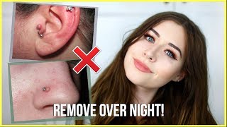 How To Get Rid Of Piercing Bumps OVERNIGHT [upl. by Aerda]