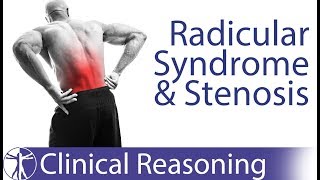 Lumbar Radicular Syndrome vs Intermittent Neurogenic ClaudicationStenosis [upl. by Ecnerret]