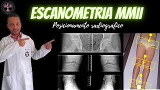 Escanometria de Membros inferiores [upl. by Shaper671]