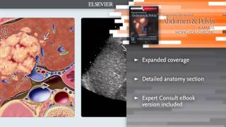 Diagnostic Ultrasound Abdomen and Pelvis [upl. by Panta]