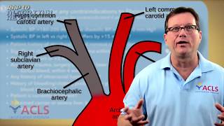 Introduction To Stroke [upl. by Burnside86]