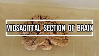 Midsagittal Section of Brain  neuroanatomy [upl. by Noreht]