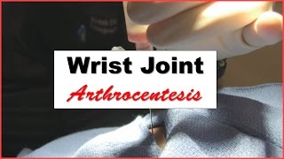 Wrist Joint Arthrocentesis Procedure [upl. by Marsden810]