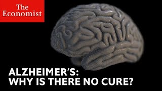 What is Alzheimers Disease – Causes Symptoms amp Treatment Simplified by Dr Berg [upl. by Neerak]