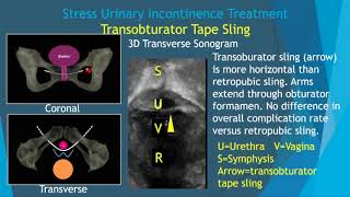 Pelvic Floor Imaging [upl. by Skye]