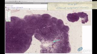 Histology Helper  Lymphoid Tissue Histology [upl. by Aivilys453]