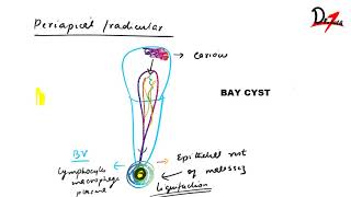 radicular cyst lecture [upl. by Cato]