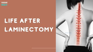 Life After Laminectomy [upl. by Aipmylo]