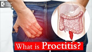 Proctitis Causes Treatment and Surgery  Dr Rajasekhar M R  Doctors Circle [upl. by Robert]