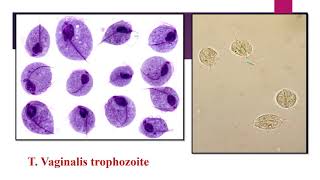 Practical Trichomonas [upl. by Rafaelle344]