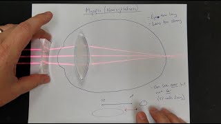 Vision Correction Normal Eyes Myopia Hyperopia Near amp Far Point Lens Power [upl. by Ilka]